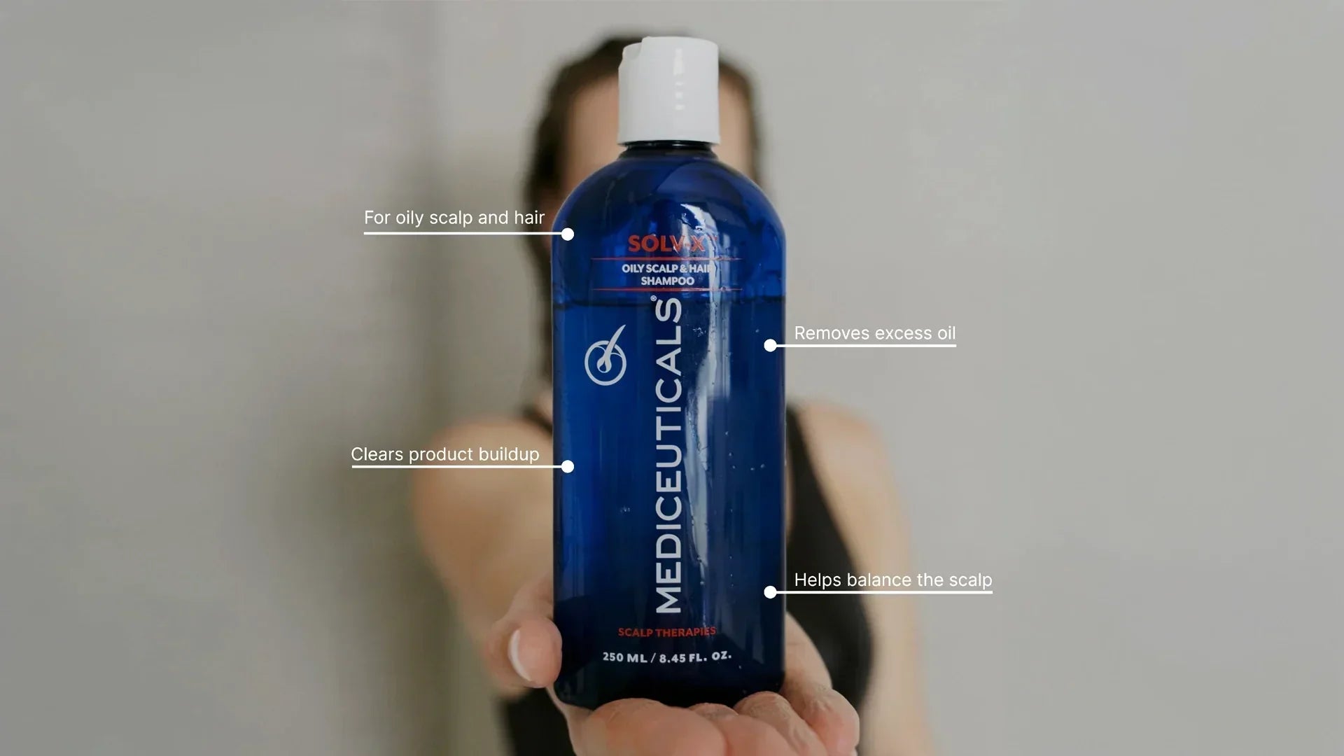shampoo vette hoofdhuid
