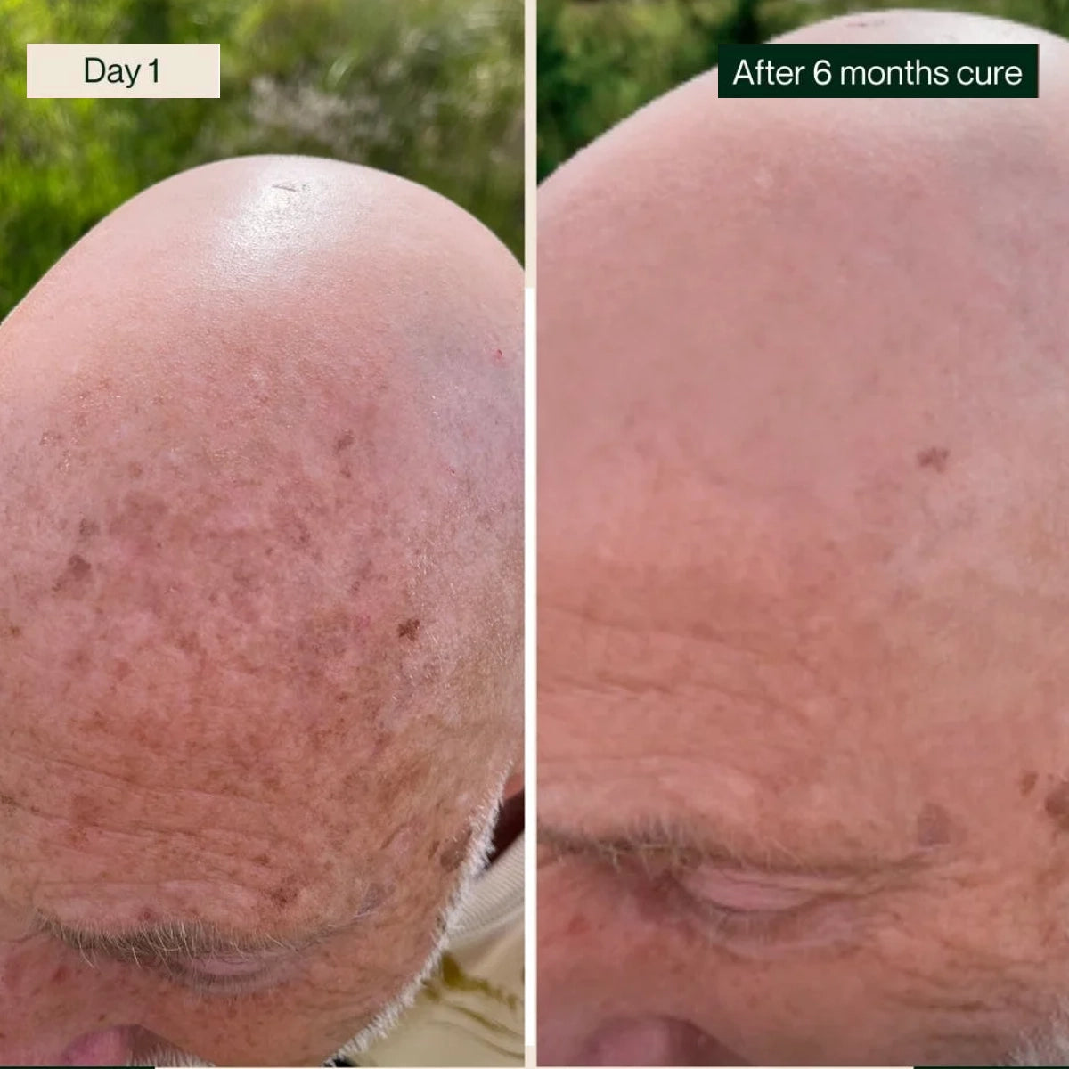 Serum against pigment and aging spots